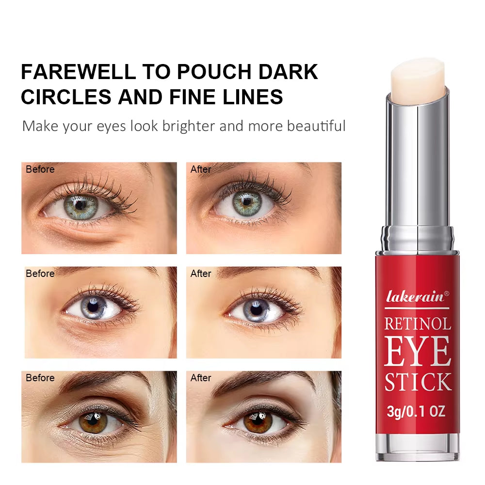 Revitalize Your Eyes: Retinol Eye Cream Stick for Dark Circles, Puffiness & Fine Lines - Instant Eye Repair Serum for All Skin Types